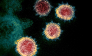 Coronavirus cells under microscope